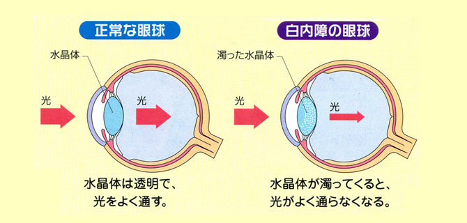 もざわ眼科