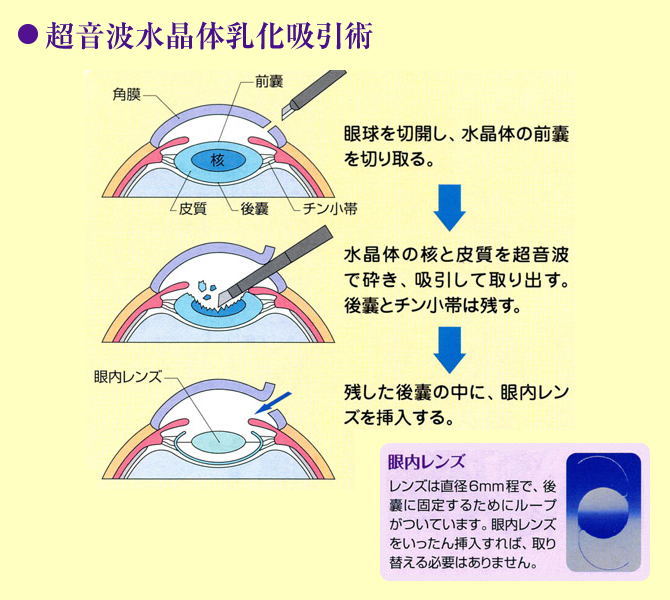 もざわ眼科