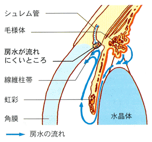 もざわ眼科