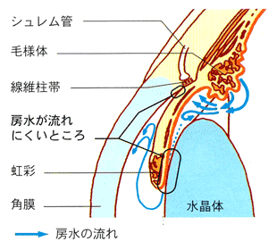 もざわ眼科