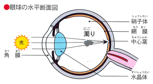 もざわ眼科